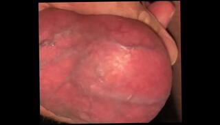Video 1049833345: solo boy, solo nut, ball stretching