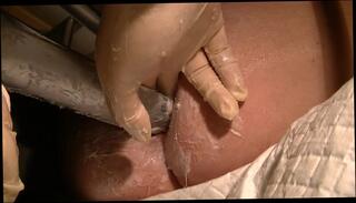 Video 202675501: speculum spread, bdsm fisting, speculum ass, gay bdsm, amateur bdsm, hd bdsm, spread ass hole