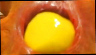 Video 1506604401: anal toys fisting, ass fisted toyed, gay anal toy, anal toy stretching, ass play
