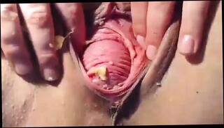 Video 1654780751: piss prolapse, piss fetish, prolapsed ass fucked, anal prolapse fucking, prolapse anal sex, amateur fetish sex, anal prolapse play, clit pissing, butt play fetish, fuck piss loving, piss straight, prolapse close, fucking copulating, clit inserts, coitus