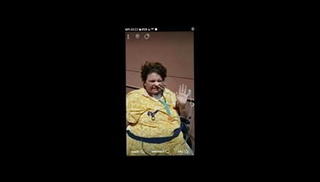 Video 528476701: bbw amputee, mature amputee, straight medical