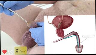 Video 1664647481: fetish doctor gay, solo masturbation uncut, gay doctor straight, amateur fetish masturbation, sounding urethral fetish, gay doctor plays, doctor guy gay, solo climax, solo masturbation hd, doctors clinic, american doctor