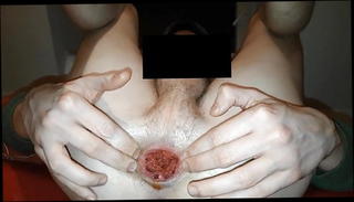 Video 820427901: horny skinny twink, skinny gay twink, skinny twinks anal, twink prolapse