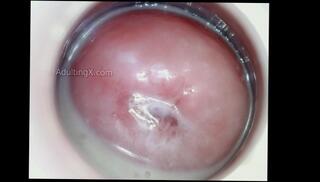 Video 1624380973: fetish solo masturbation, speculum creampie, pussy solo female masturbation, solo masturbation moaning, amateur solo female masturbation, amateur creampie hardcore, cum creampie pussy, vagina creampie, breeding creampie impregnation, shrinking fetish, giantess fetish, behind creampie, cream fetish, creampie fantasies, camera creampie