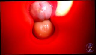 Video 1658548473: solo dildo pov, dildo toy fetish cock, double penetration big dildo, trans solo dildo, double dildo masturbation, amateur double dildo, double dick dildo, dildo cock insertion, cock pov close, solo rubbing cock, dildo precum