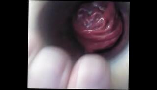 Video 1068534925: plug closeup, anal prolapse, prolapse masturbation, prolapsed ass, creamy masturbation anal