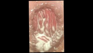 Video 1626108793: solo dildo squirt, solo anal dildo ride, anal dildo toy fetish, dildo anal prolapse, squirt big dildo anal, squirts anal milk, dildo solo boy, solo amateur dildoing, gay solo dildo, fetish solo porn, bisexual dildo, solo bisexual male, dildo deep anal ride, toys dildo anal stretching, hardcore dildo ride, dildo riding training, riding dildo close, hot dildo ride, dildoing french, canadian anal