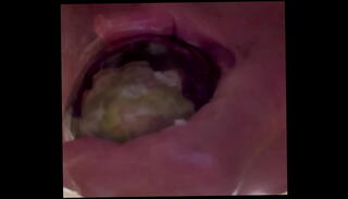 Video 1388096055: prolapse fuck, ass toying anal, gay anal toy