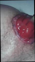 Video 284345301: prolapse, gay ass fisting, ass fisting man